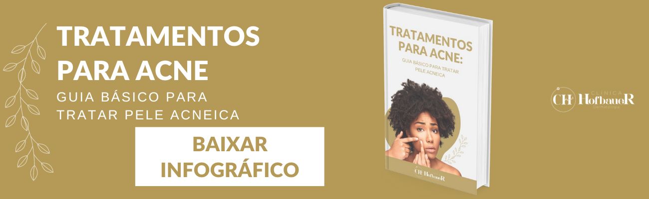 Tratamentos para Acne