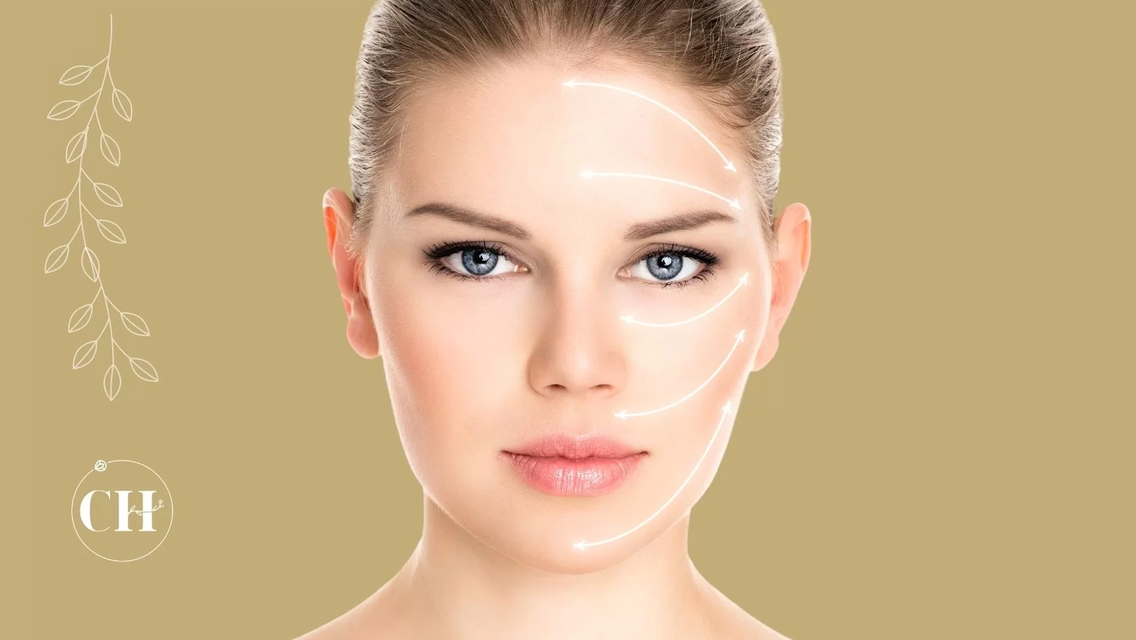 sculptra ou radiesse