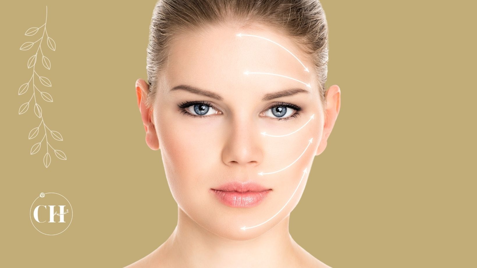 sculptra ou radiesse