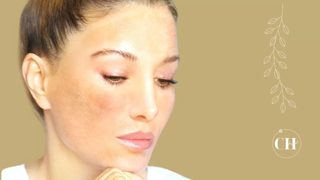 tipos de mancha na pele